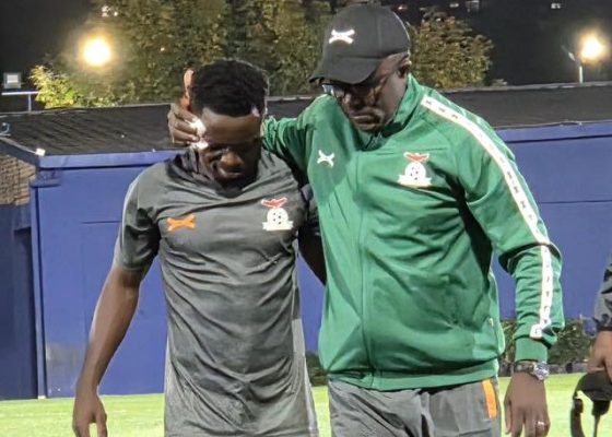 ARGENTINA FRIENDLY: Prince Mumba Suffers Facial Injury But Stable